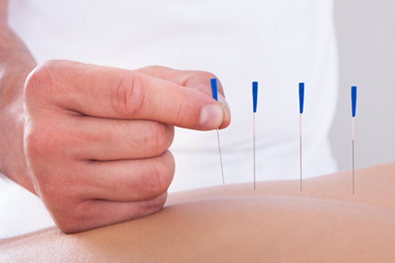 Sakarya Akupunktur | Alternatif Klinik